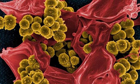 Staphylococcus aureus als oorzaak van bacteriële prostatitis