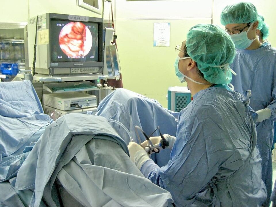 chirurgische behandeling van calculeuze prostatitis