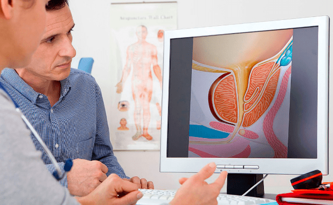 Diagnose van prostatitis