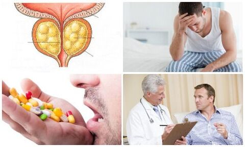 prostatitis bij mannen